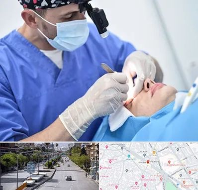 جراح سرطان چشم در خیابان زند شیراز 