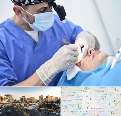 جراح سرطان چشم در منطقه 7 تهران 