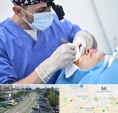 جراح سرطان چشم در جنوب تهران 