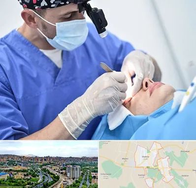 جراح سرطان چشم در شهریار