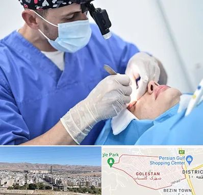 جراح سرطان چشم در شهرک گلستان شیراز 