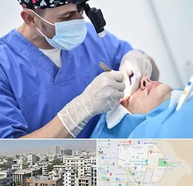 جراح سرطان چشم در منطقه 14 تهران 