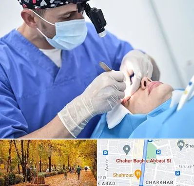 جراح سرطان چشم در چهارباغ اصفهان 