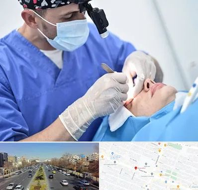جراح سرطان چشم در بلوار معلم مشهد 