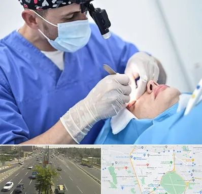جراح سرطان چشم در منطقه 17 تهران 