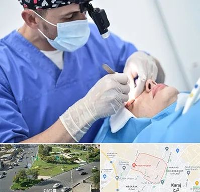 جراح سرطان چشم در شاهین ویلا کرج 