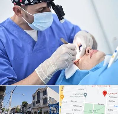 جراح سرطان چشم در افسریه 