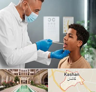 دکتر سرطان دهان در کاشان
