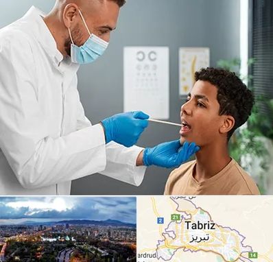 دکتر سرطان دهان در تبریز