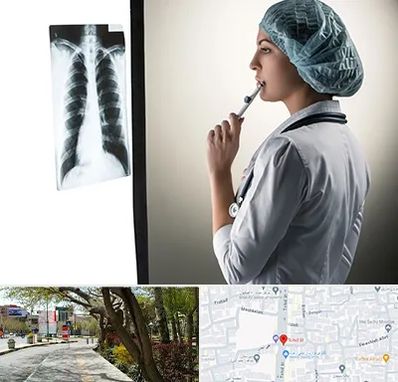 دکتر سرطان ریه در خیابان توحید اصفهان 