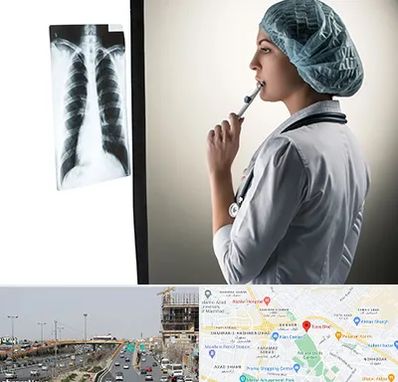 دکتر سرطان ریه در بلوار توس مشهد 