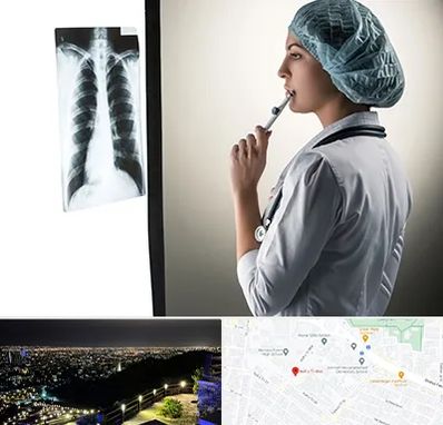 دکتر سرطان ریه در هفت تیر مشهد 