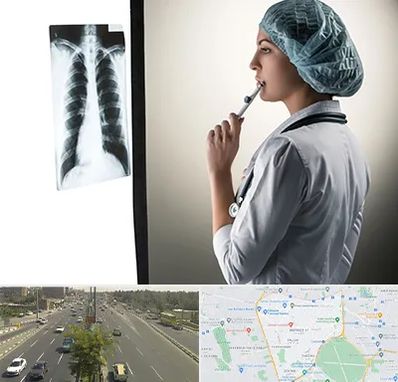 دکتر سرطان ریه در منطقه 17 تهران 