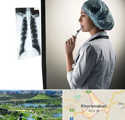 دکتر سرطان ریه در خرم آباد