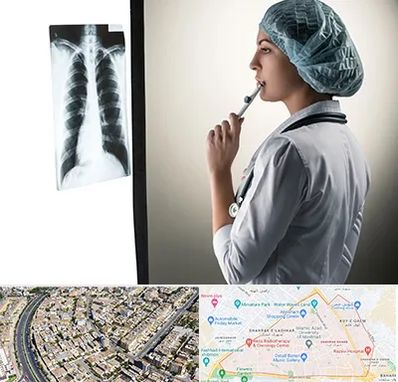 دکتر سرطان ریه در شهرک غرب مشهد 