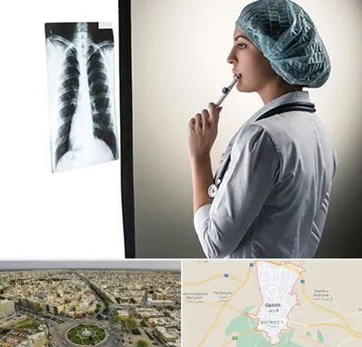 دکتر سرطان ریه در قزوین