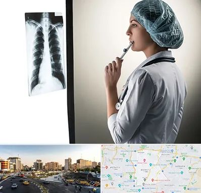 دکتر سرطان ریه در منطقه 7 تهران 
