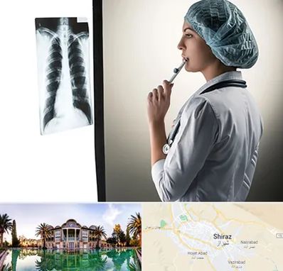 دکتر سرطان ریه در شیراز