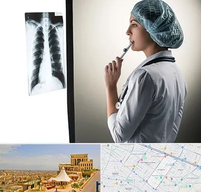 دکتر سرطان ریه در هاشمیه مشهد 