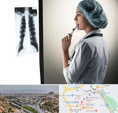 دکتر سرطان ریه در معالی آباد شیراز 