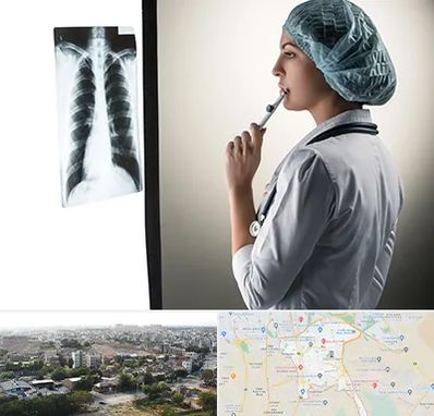 دکتر سرطان ریه در منطقه 20 تهران 