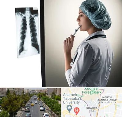 دکتر سرطان ریه در شهران 