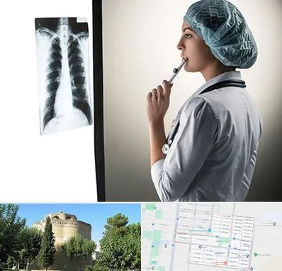 دکتر سرطان ریه در مرداویج اصفهان 