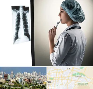 دکتر سرطان ریه در شرق تهران 