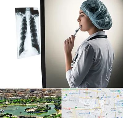 دکتر سرطان ریه در منطقه 9 تهران 