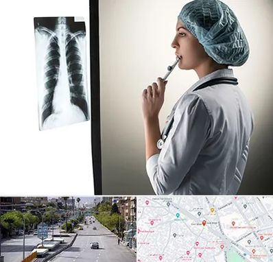 دکتر سرطان ریه در خیابان زند شیراز 