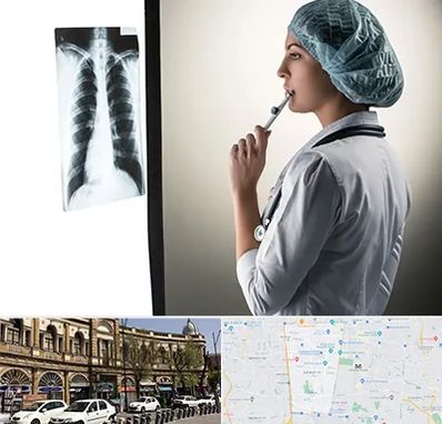 دکتر سرطان ریه در منطقه 11 تهران 
