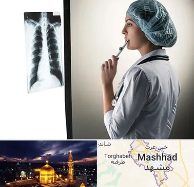 دکتر سرطان ریه در مشهد