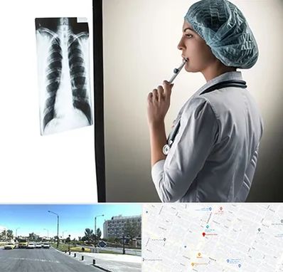 دکتر سرطان ریه در بلوار کلاهدوز مشهد 