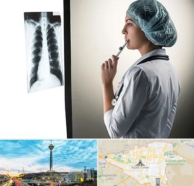 دکتر سرطان ریه در تهران