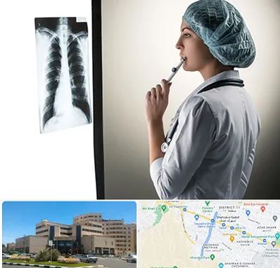 دکتر سرطان ریه در صیاد شیرازی مشهد 