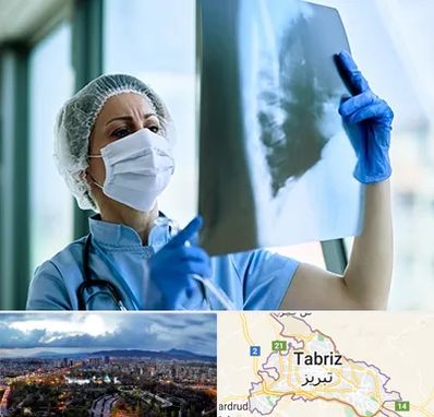 جراح سرطان ریه در تبریز