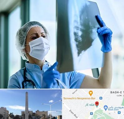 جراح سرطان ریه در فلکه گاز شیراز 