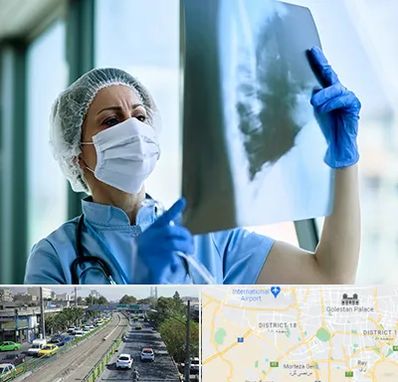 جراح سرطان ریه در جنوب تهران 
