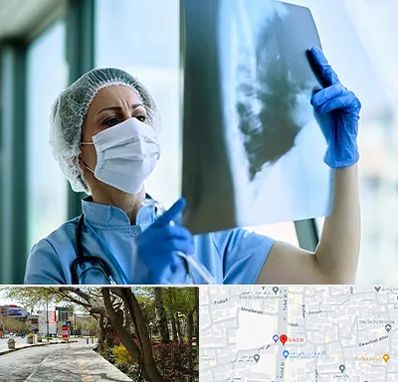 جراح سرطان ریه در خیابان توحید اصفهان 