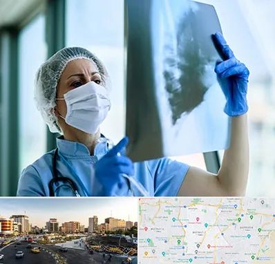 جراح سرطان ریه در منطقه 7 تهران 