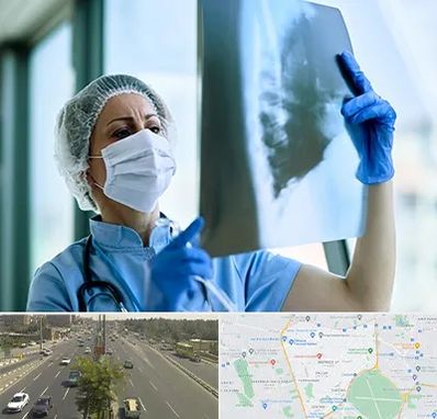 جراح سرطان ریه در منطقه 17 تهران 