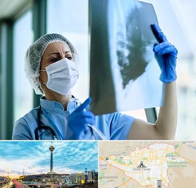 جراح سرطان ریه در تهران