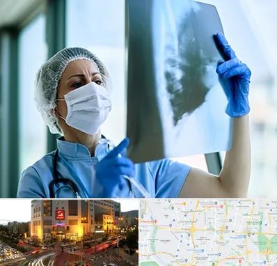جراح سرطان ریه در جنت آباد تهران 