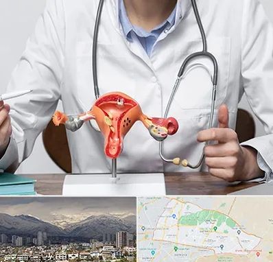 جراح سرطان رحم در منطقه 4 تهران 