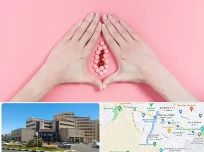 دکتر سرطان واژن در صیاد شیرازی مشهد 