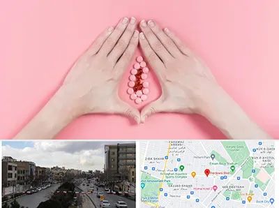 دکتر سرطان واژن در بلوار فردوسی مشهد 