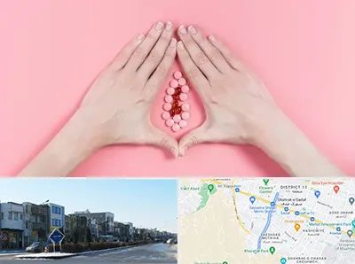 دکتر سرطان واژن در شریعتی مشهد 