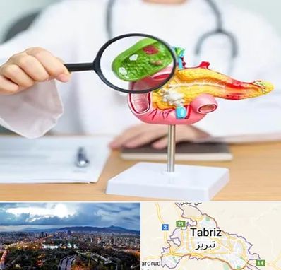 جراح سرطان پانکراس در تبریز
