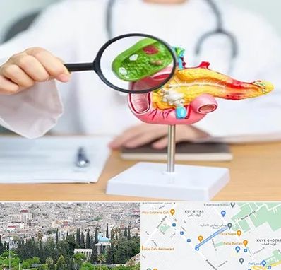 جراح سرطان پانکراس در محلاتی شیراز 