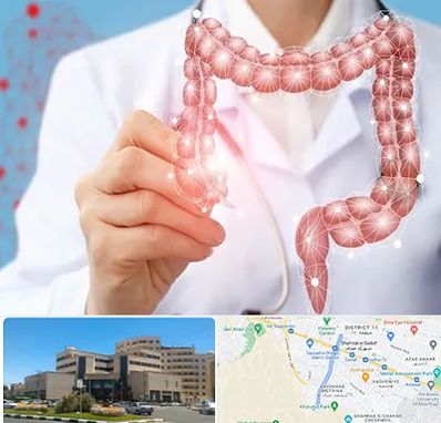 جراح سرطان روده بزرگ در صیاد شیرازی مشهد 